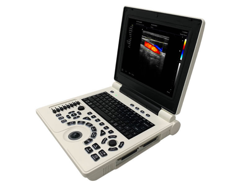 C2 Ноутбук цветной доплеровский ультразвуковой диагностический аппарат 
