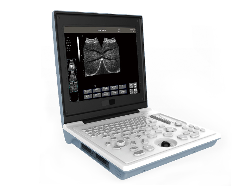 SS - 6B Ноутбук Полноцифровой ультразвуковой диагностический прибор 