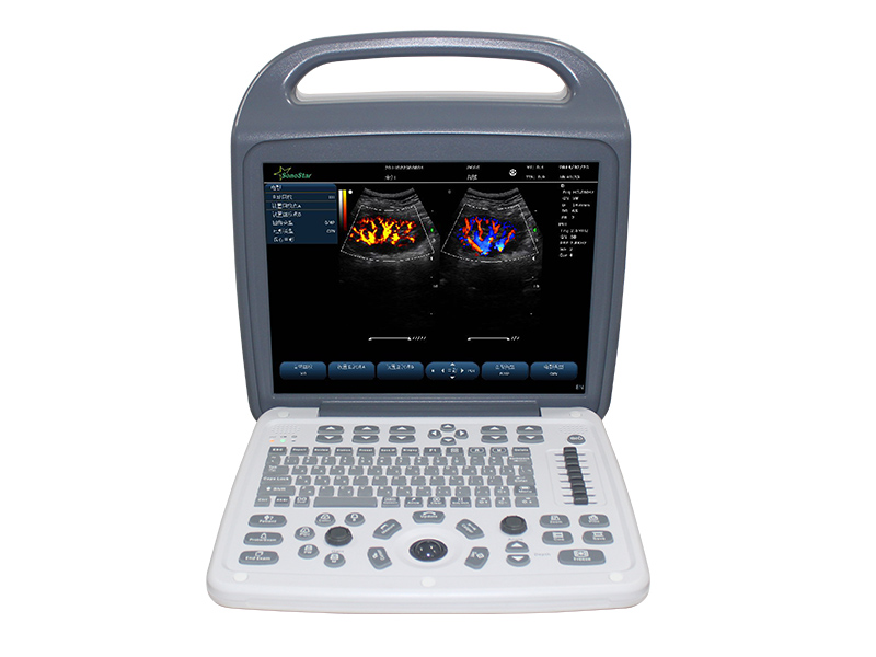 C10M Портативный цветной ультразвуковой диагностический прибор 