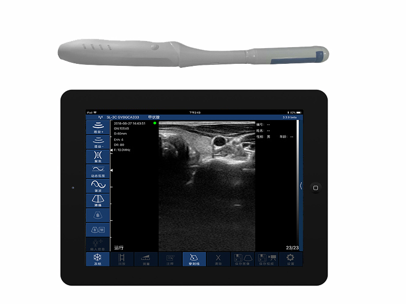 4CR直肠T型双平面无线探头式掌上彩超