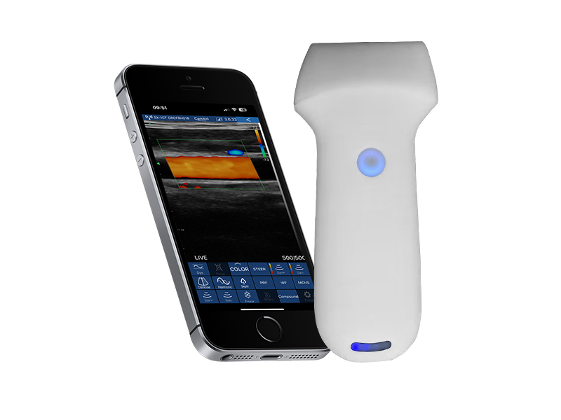 8L 高配线阵无线探头式掌上彩超