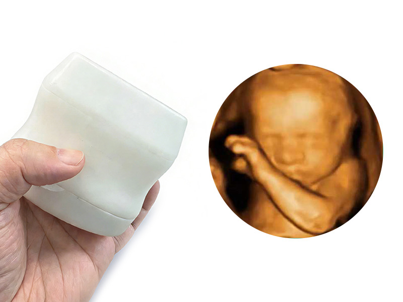 三维(3D)扫描立体成像掌上超声